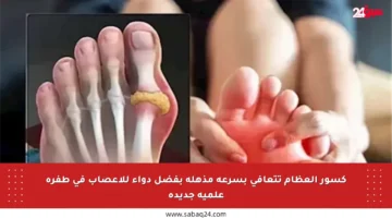 كسور العظام تتعافى بسرعة مذهلة بفضل دواء للأعصاب في طفرة علمية جديدة